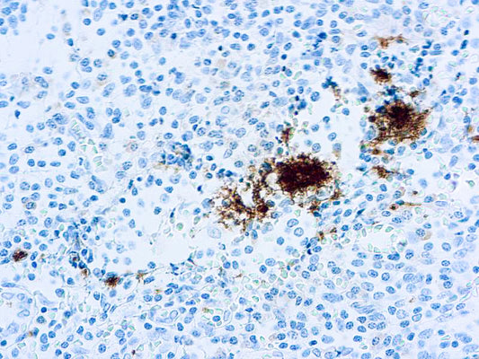 CD61 Platelet Glycoprotein Illa