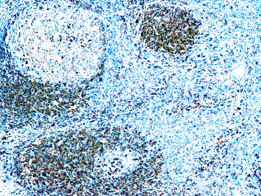 CD79a B-Cell