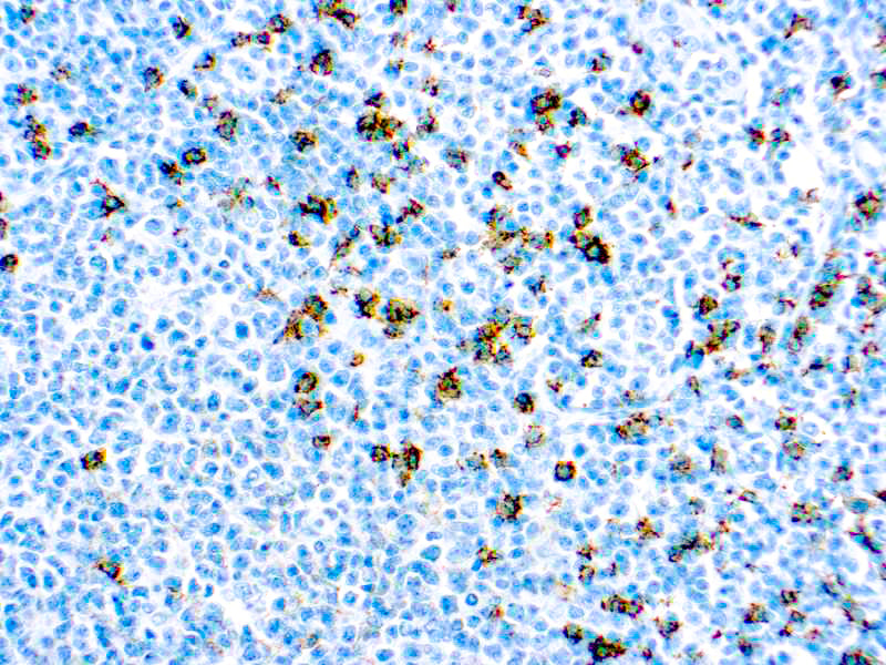 CD8 T-Cell