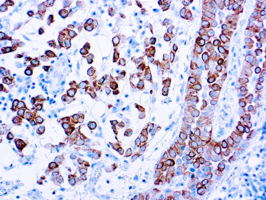 Cytokeratin 5