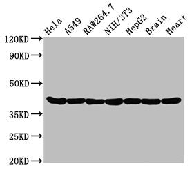 ACTA1 Recombinant Monoclonal Antibody