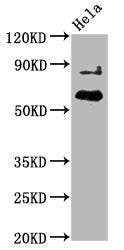 Phospho-AKT1 (T450) Recombinant Monoclonal Antibody