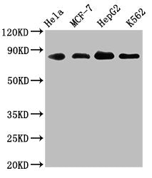 ARNT Recombinant Monoclonal Antibody