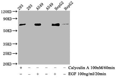 Phospho-ATF2 (T71) Recombinant Monoclonal Antibody