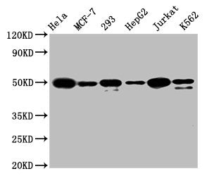 ATF4 Recombinant Monoclonal Antibody
