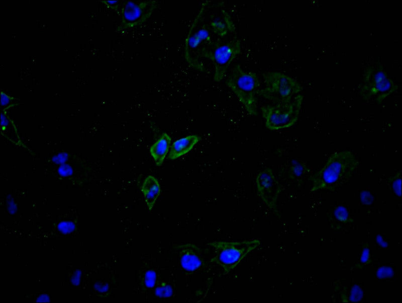 ATP7B Recombinant Monoclonal Antibody