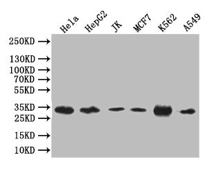 CASP3 Recombinant Monoclonal Antibody