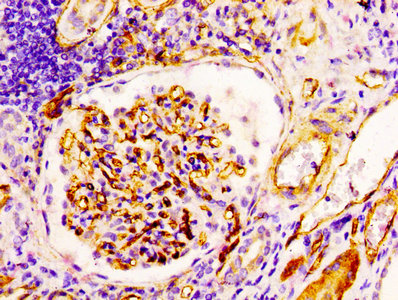 CD34 Recombinant Monoclonal Antibody