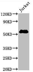 CD4 Recombinant Monoclonal Antibody