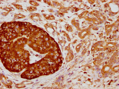 CD63 Recombinant Monoclonal Antibody