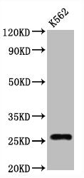 CD81 Recombinant Monoclonal Antibody