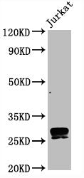 CD99 Recombinant Monoclonal Antibody