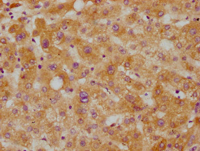 CETP Recombinant Monoclonal Antibody