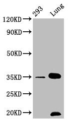 CNN1 Recombinant Monoclonal Antibody