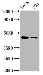 Phospho-CREB1 (S133) Recombinant Monoclonal Antibody
