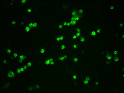 Phospho-CTNNB1 (S33/S37) Recombinant Monoclonal Antibody