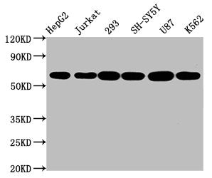 CYP19A1 Recombinant Monoclonal Antibody