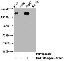 Phospho-EGFR (Y1068) Recombinant Monoclonal Antibody