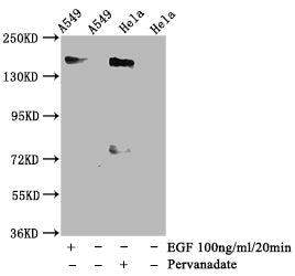Phospho-EGFR (Y1092) Recombinant Monoclonal Antibody