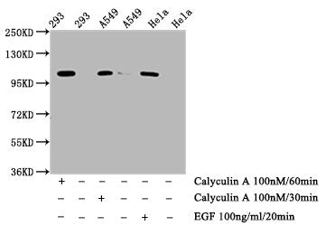 Phospho-ERN1 (S724) Recombinant Monoclonal Antibody