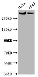 Phospho-MTOR (S2448) Recombinant Monoclonal Antibody