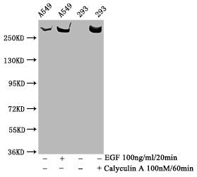 Phospho-MTOR (S2481) Recombinant Monoclonal Antibody
