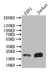 FTH1 Recombinant Monoclonal Antibody