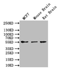 GFAP Recombinant Monoclonal Antibody