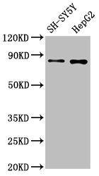 GOLM1 Recombinant Monoclonal Antibody