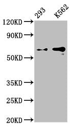 GPC3 Recombinant Monoclonal Antibody