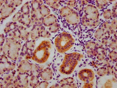 Phospho-GSK3A/GSK3B (Y216 + Y279) Recombinant Monoclonal Antibody