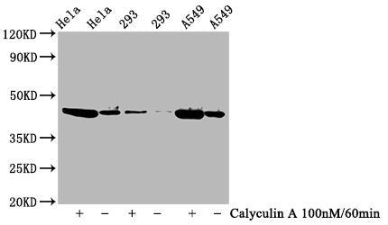 Phospho-GSK3B (Ser9) Recombinant Monoclonal Antibody