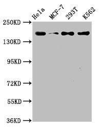 HDAC9 Recombinant Monoclonal Antibody