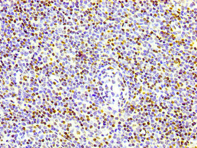 Phospho-Histone H1.4 (T17) Recombinant Monoclonal Antibody