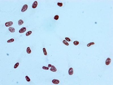 Acetyl-Histone H2A type 1-B/E (K9) Recombinant Monoclonal Antibody
