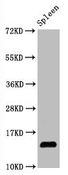 Hydroxyl-Histone H2A type 1-B/E (Y39) Recombinant Monoclonal Antibody