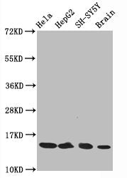 Acetyl-Histone H3.1（K14）Recombinant Monoclonal Antibody