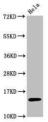 Acetyl-Histone H3.1 (K56) Recombinant Monoclonal Antibody