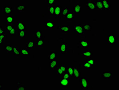 Mono-methyl-Histone H4 (K16) Recombinant Monoclonal Antibody