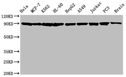 HSP90AA1/HSP90AB1 Recombinant Monoclonal Antibody