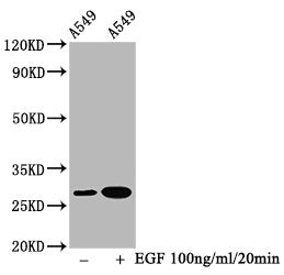 Phospho-HSPB1 (S78) Recombinant Monoclonal Antibody
