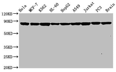 HSP90AA1 Recombinant Monoclonal Antibody