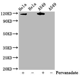 Phospho-JAK2 (Y1007 + Y1008) Recombinant Monoclonal Antibody