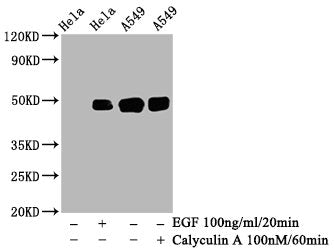 Phospho-JUN (S63) Recombinant Monoclonal Antibody