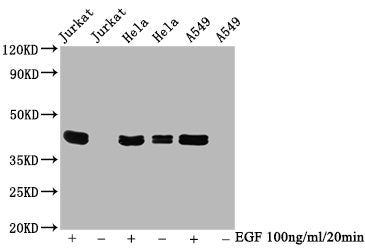 Phospho-MAPK3 (T202/Y204) + MAPK1 (T185/Y187) Recombinant Monoclonal Antibody
