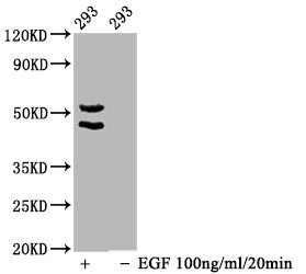 Phospho-MAPK8/MAPK9/MAPK10 (T183/T183/T221) Recombinant Monoclonal Antibody