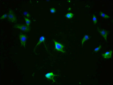 Phospho-MAPT (S324) Recombinant Monoclonal Antibody