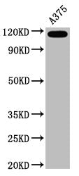 CD146 Recombinant Monoclonal Antibody