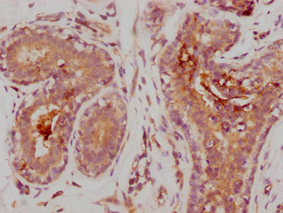 MMP9 Recombinant Monoclonal Antibody