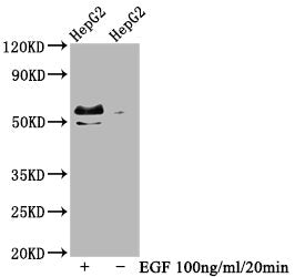 Phospho-MYC (T58+S62) Recombinant Monoclonal Antibody